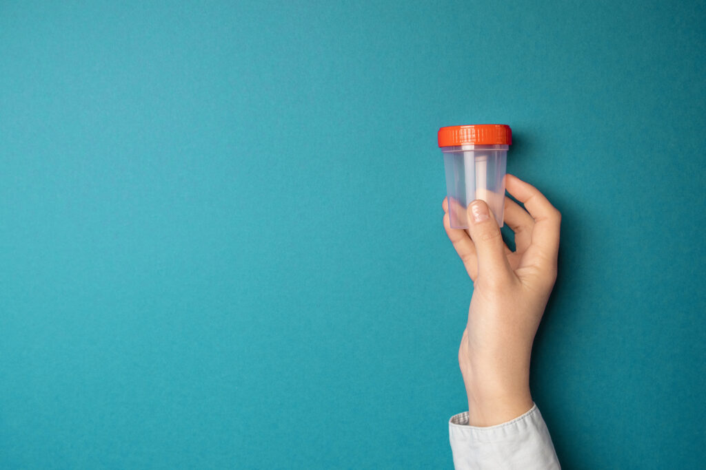 Hand holding a specimen cup against a teal background, representing how to start a drug and alcohol testing business.